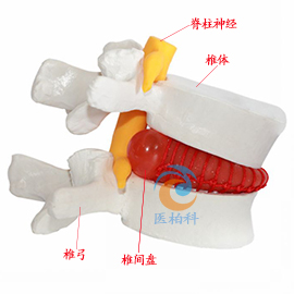 腰椎间盘突出演示模型